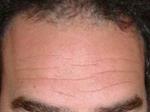 تفسير رؤية جبين في المنام أو الحلم